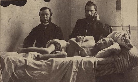 This photograph of Corporal Calvin Bates of Co. E, 20th Maine Infantry, reminds us that not all amputations resulted from bullet wounds. A prisoner at Andersonville, Bates suffered inhumane treatment at the hands of his prison guards. His maltreatment resulted in illness, decay, and ultimately the amputation of his feet.