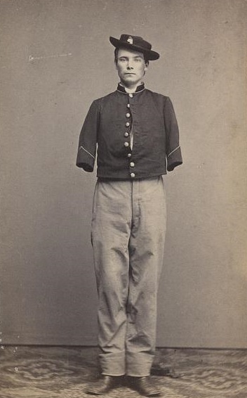 Many soldiers, like Private William Sargent of Co. E, 53rd Pennsylvania Infantry (above), continued to don their uniforms after their amputations. Federals and Confederates alike worried about the immoral and idle behavior that would arise if disabled soldiers did not return to work and provide for themselves. The creation of the Invalid Corps (later renamed the Veteran Reserve Corps) allowed amputees and other wounded soldiers to serve as aides to the army—cooks, nurses, or prison guards—or to return to combat if their injuries were not too severe.