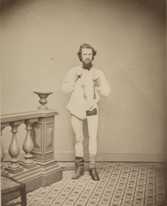 Private George W. Lemon (above) was among the soldiers who elected to use a prosthesis. As early as 1862, the Union government began allocating resources for wounded veterans to purchase an artificial arm or leg. Several Confederate states followed suit in 1864. Payments of $50-$75 covered the cost of the prosthesis as well as any required travel to have the soldier outfitted with his new limb.  