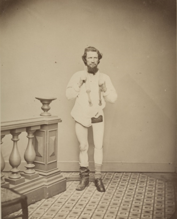 Private George W. Lemon (above) was among the soldiers who elected to use a prosthesis. As early as 1862, the Union government began allocating resources for wounded veterans to purchase an artificial arm or leg. Several Confederate states followed suit in 1864. Payments of $50-$75 covered the cost of the prosthesis as well as any required travel to have the soldier outfitted with his new limb. 